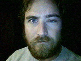 hive split face after bee sting